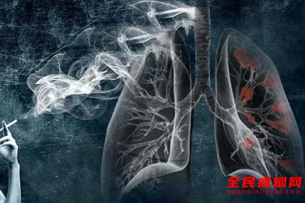 慢阻肺疾病和吸烟有关吗，吸烟对慢阻肺关系密切吗