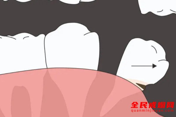 吸烟对于牙齿及口腔的危害，吸烟对口腔牙齿有危害吗