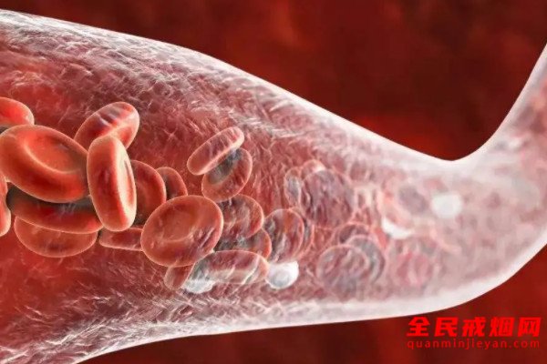 吸烟所招致的一种血管疾病“脉管炎”，为什么吸烟是造成脉管炎最重要的因素